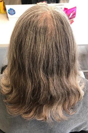Grey-hair-before-colour-correction-at-Reeds-Hairdressers-in-Cambridge